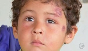 ‘Anjo protegeu meu filho’, diz mãe de menino arremessado de carro em capotamento