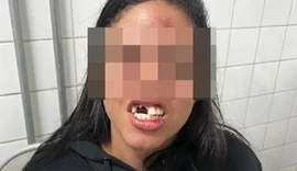 Homem agride três mulheres dentro de um bar e deixa uma com dentes quebrados