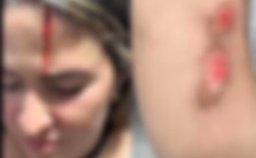 Mulher sobrevive a tentativa de feminicídio após ser atropelada e agredida pelo ex-companheiro em Olivença