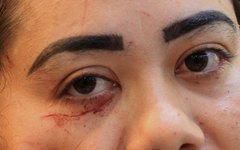 Marajulia mostra ferimentos causados pela agressão na porta do Parque das Flores