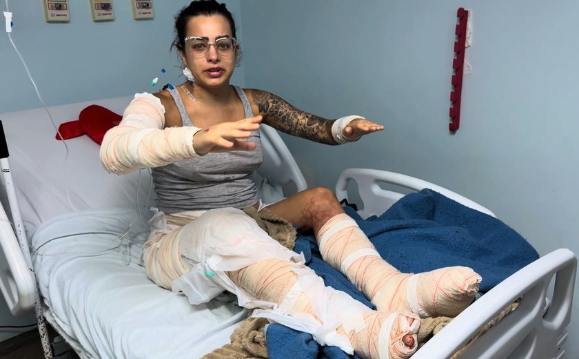 Vídeo: gasolina pode ter causado incêndio que fez vítima fatal em Maceió