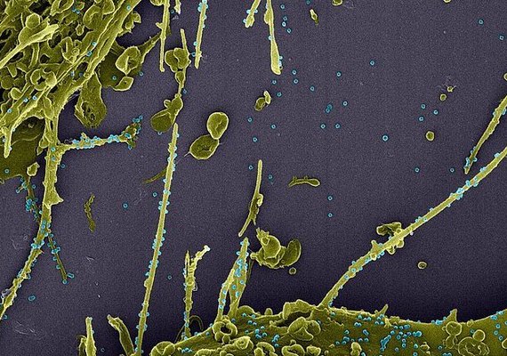 AL confirma 527 novos casos de Covid-19 e cinco mortes