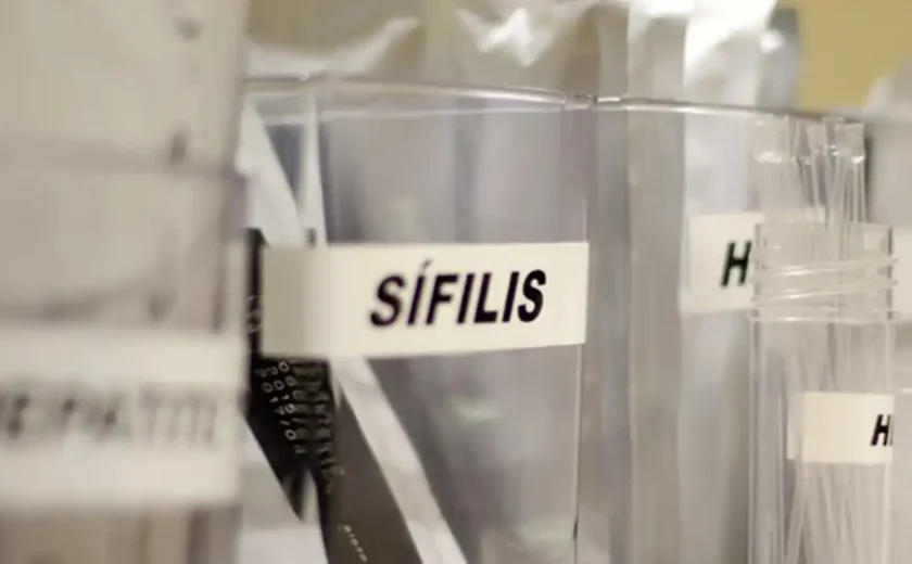 Sífilis continua em ritmo acelerado de crescimento no país