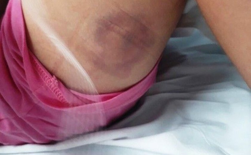 'Foi um milagre', diz mãe que viu filha ser baleada após erro de GPS
