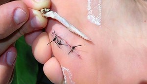 Estudo da Ufal descreve impacto dos acidentes de trabalho na renda dos pescadores