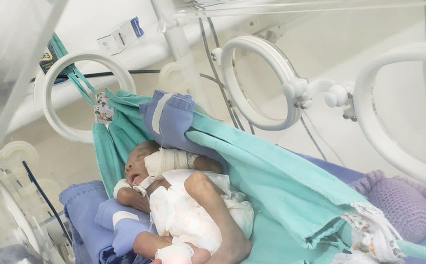 Bebês prematuros de Hospital em Arapiraca descansam em redes