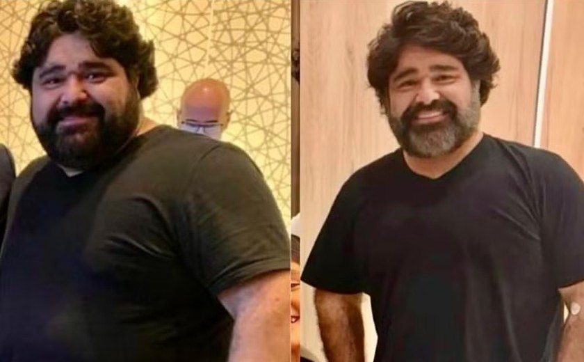 O que é Mounjaro, a caneta que fez Fabiano Menotti perder 60 kg?