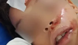 Polícia Civil apura dois casos de possíveis agressões contra crianças em Maceió