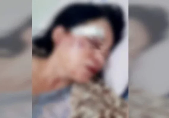 Mulher é espancada por vizinhos após festa ser denunciada por barulho