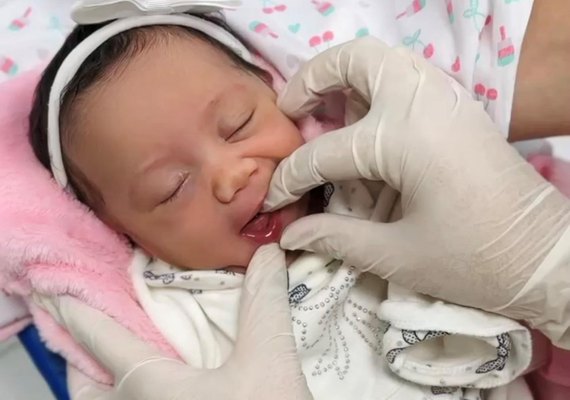 Hospital da Mulher registra mais de 410 Testes da Linguinha em recém-nascidos em 2024