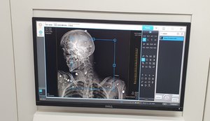 IML de Maceió começa a operar novo software para exames com scanner corporal