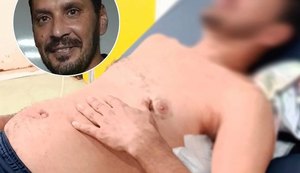 Nando do Reggae passa por cirurgia após ser ferido durante discussão política em Viçosa