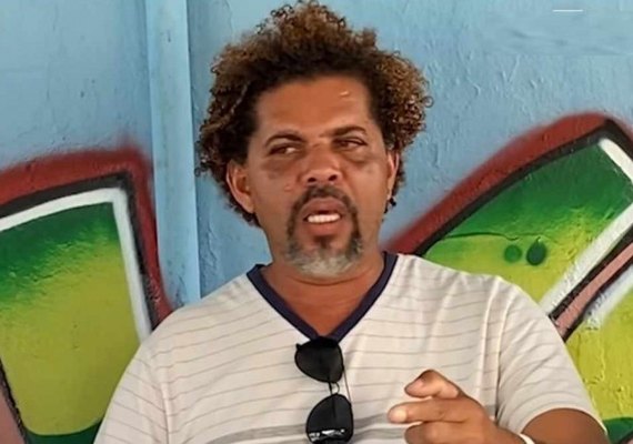 Veja vídeo! Morador de rua espancado por personal trainer dá sua versão: 'Sou a única vítima'