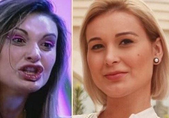 Urach mostra antes e depois da conversão e choca fãs