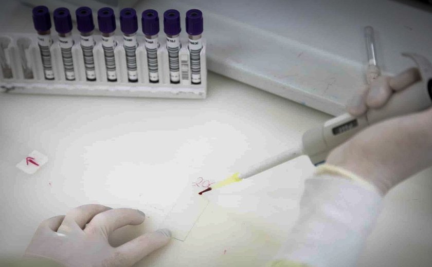 Paciente em SP com suspeita de ebola testa positivo para meningite