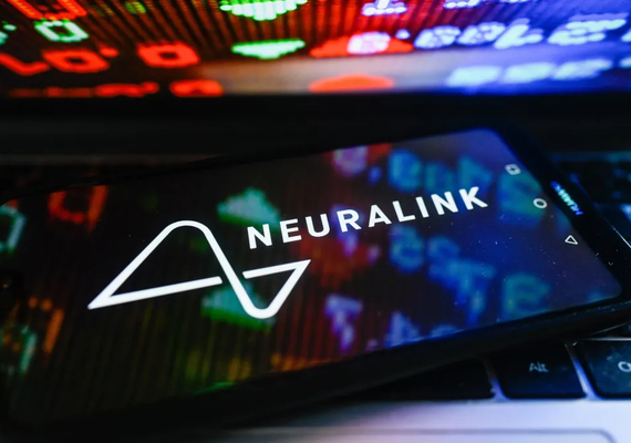 Neuralink: o que você precisa saber sobre o implante cerebral
