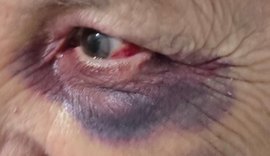 Polícia Civil prende dois homens por violência doméstica em Palmeira dos Índios