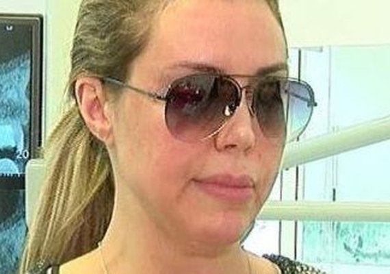 Renata Banhara aparece com rosto paralisado em 1ª entrevista pós-cirurgias